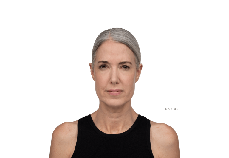 664c342db60649b6a8169af3_lisa-30-right-p-2000